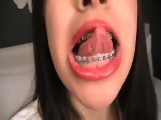 best of Tongue piercing vore braces